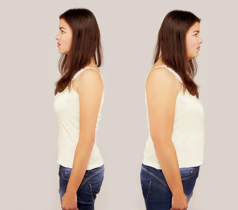 Testimonios y opiniones de Xenical Orlistat Alli